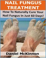Nail Fungus Treatment: How To Naturally Cure Your Nail Fungus Naturally In Just 60 Days - Book Cover