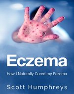 Eczema: How I Naturally Cured my Eczema - Book Cover